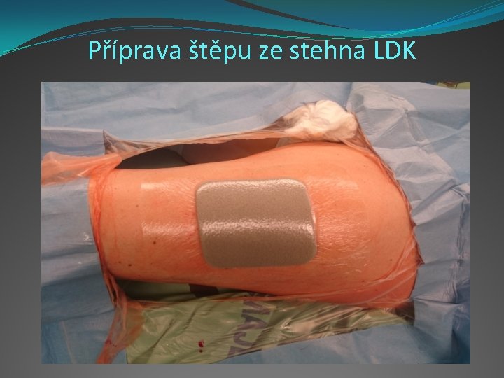 Příprava štěpu ze stehna LDK 