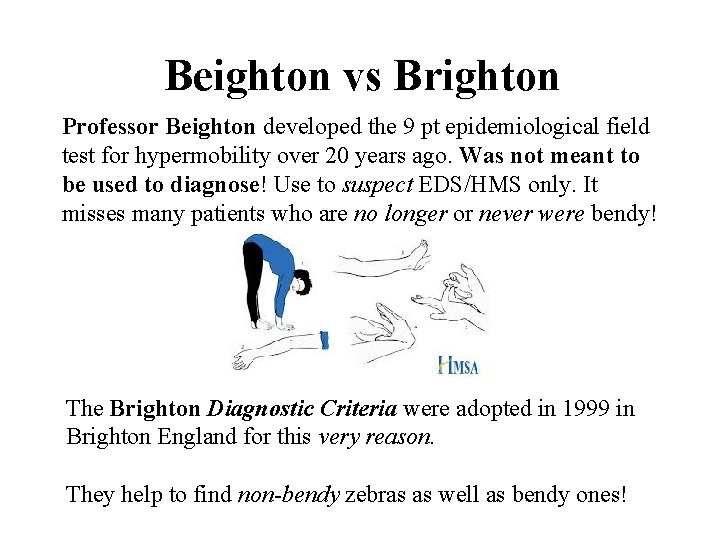 Beighton vs Brighton Professor Beighton developed the 9 pt epidemiological field test for hypermobility