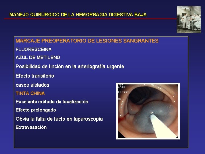 MANEJO QUIRÚRGICO DE LA HEMORRAGIA DIGESTIVA BAJA MARCAJE PREOPERATORIO DE LESIONES SANGRANTES FLUORESCEINA AZUL