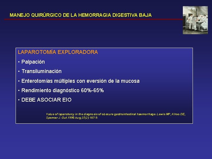 MANEJO QUIRÚRGICO DE LA HEMORRAGIA DIGESTIVA BAJA LAPAROTOMÍA EXPLORADORA • Palpación • Transiluminación •