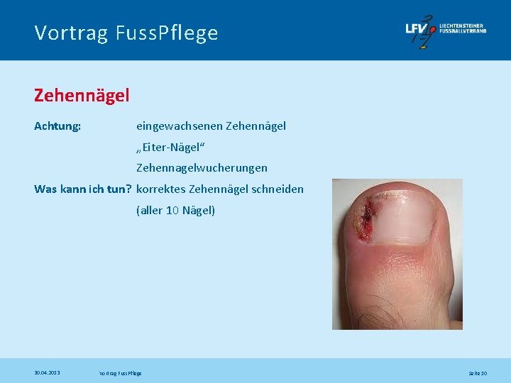 Vortrag Fuss. Pflege Zehennägel Achtung: eingewachsenen Zehennägel „Eiter-Nägel“ Zehennagelwucherungen Was kann ich tun? korrektes