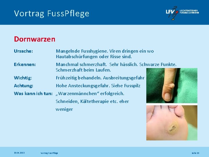 Vortrag Fuss. Pflege Dornwarzen Ursache: Erkennen: Mangelnde Fusshygiene. Viren dringen ein wo Hautabschürfungen oder