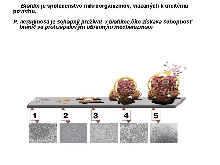 Biofilm je společenstvo mikroorganizmov, viazaných k určitému povrchu. P. aeruginosa je schopný prežívať v