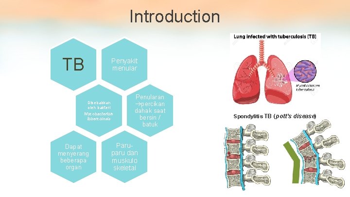 Introduction TB Penyakit menular Disebabkan oleh bakteri Mycobacterium tuberculosis Dapat menyerang beberapa organ Penularan