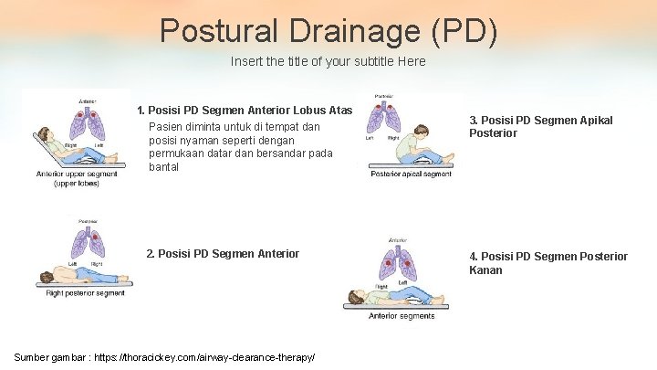 Postural Drainage (PD) Insert the title of your subtitle Here 1. Posisi PD Segmen