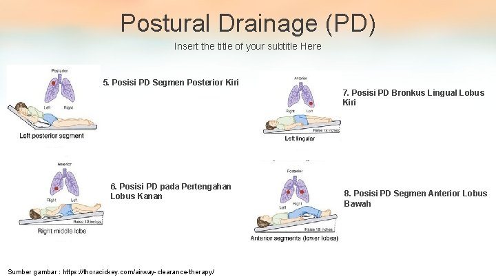 Postural Drainage (PD) Insert the title of your subtitle Here 5. Posisi PD Segmen