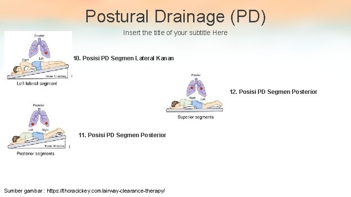 Postural Drainage (PD) Insert the title of your subtitle Here 10. Posisi PD Segmen