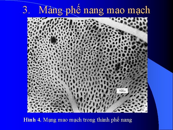 3. Màng phế nang mao mạch Hình 4. Mạng mao mạch trong thành phế