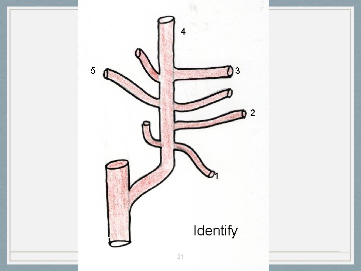 4 5 3 2 1 Identify 21 