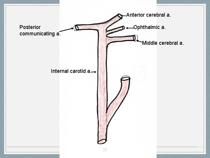 Anterior cerebral a. Posterior communicating a. Ophthalmic a. Middle cerebral a. Internal carotid a.