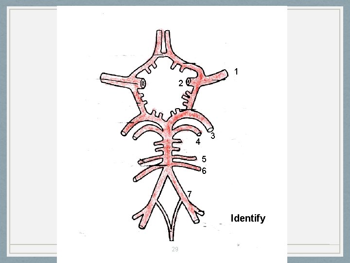 1 2 3 4 5 6 7 Identify 29 