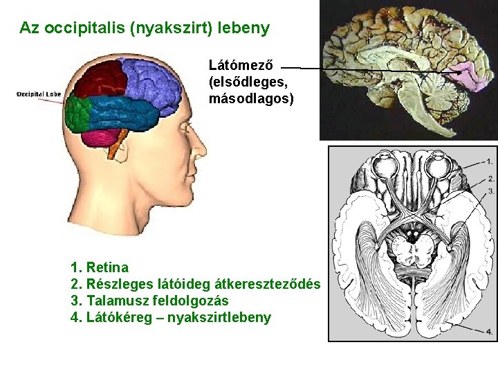 Az occipitalis (nyakszirt) lebeny Látómező (elsődleges, másodlagos) 1. Retina 2. Részleges látóideg átkereszteződés 3. Az occipitalis (nyakszirt) lebeny Látómező (elsődleges, másodlagos) 1. Retina 2. Részleges látóideg átkereszteződés 3.