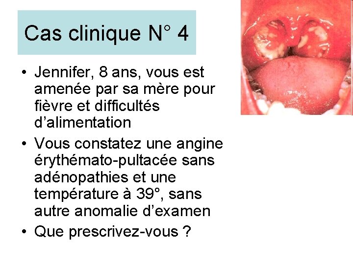 Cas clinique N° 4 • Jennifer, 8 ans, vous est amenée par sa mère