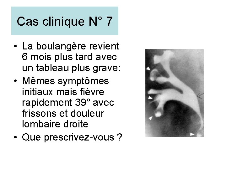 Cas clinique N° 7 • La boulangère revient 6 mois plus tard avec un