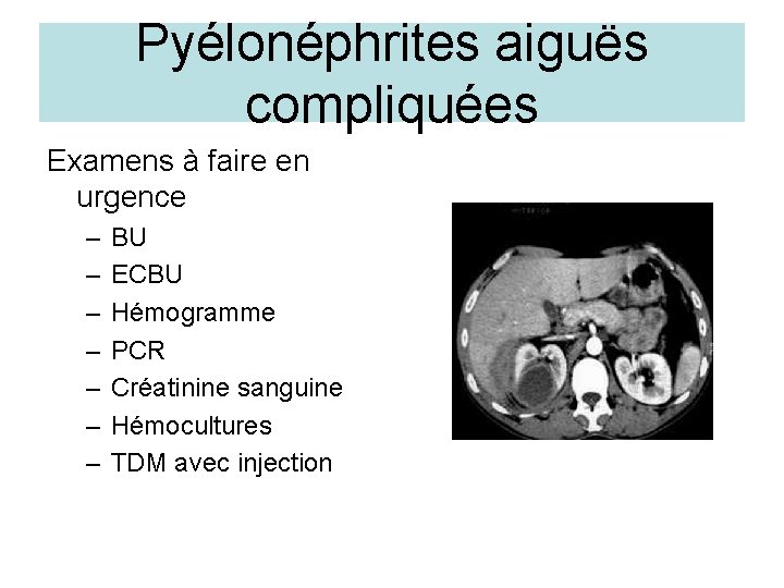Pyélonéphrites aiguës compliquées Examens à faire en urgence – – – – BU ECBU