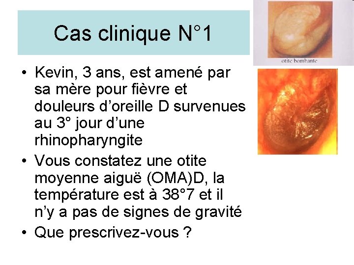Cas clinique N° 1 • Kevin, 3 ans, est amené par sa mère pour