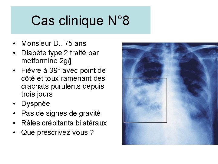 Cas clinique N° 8 • Monsieur D. . 75 ans • Diabète type 2