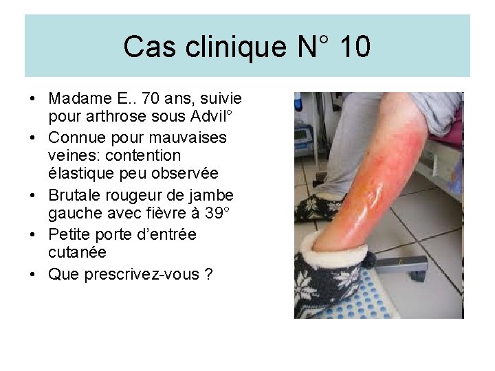 Cas clinique N° 10 • Madame E. . 70 ans, suivie pour arthrose sous