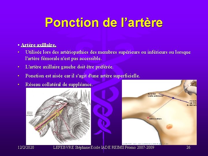 Ponction de l’artère • Artère axillaire. • Utilisée lors des artériopathies des membres supérieurs