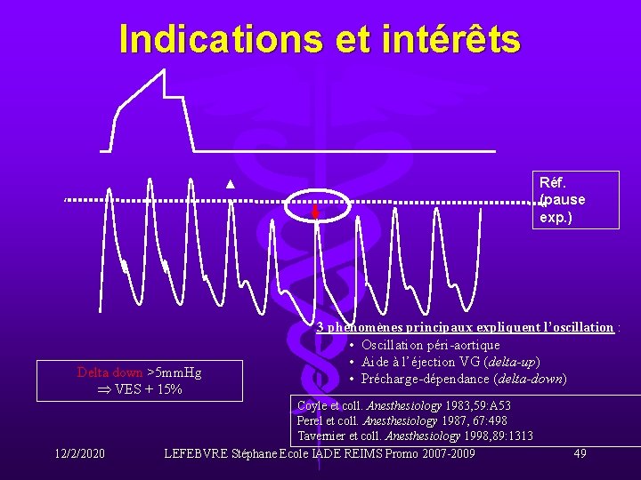 Indications et intérêts Réf. (pause exp. ) Delta down >5 mm. Hg VES +