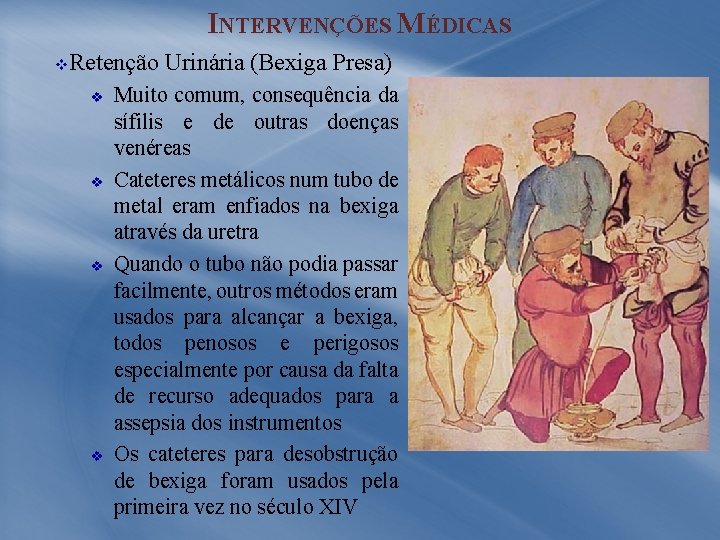 INTERVENÇÕES MÉDICAS v Retenção Urinária (Bexiga Presa) v v Muito comum, consequência da sífilis