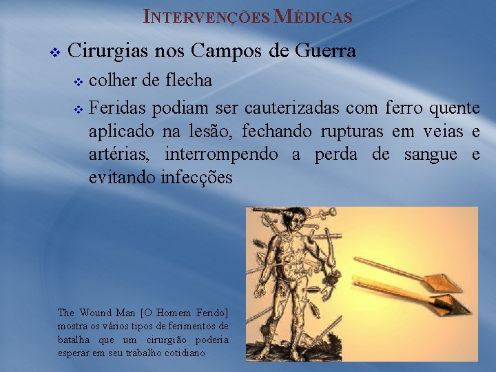 INTERVENÇÕES MÉDICAS v Cirurgias nos Campos de Guerra colher de flecha v Feridas podiam