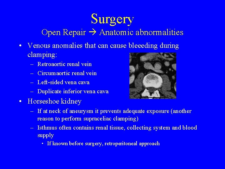 Surgery Open Repair Anatomic abnormalities • Venous anomalies that can cause bleeeding during clamping: