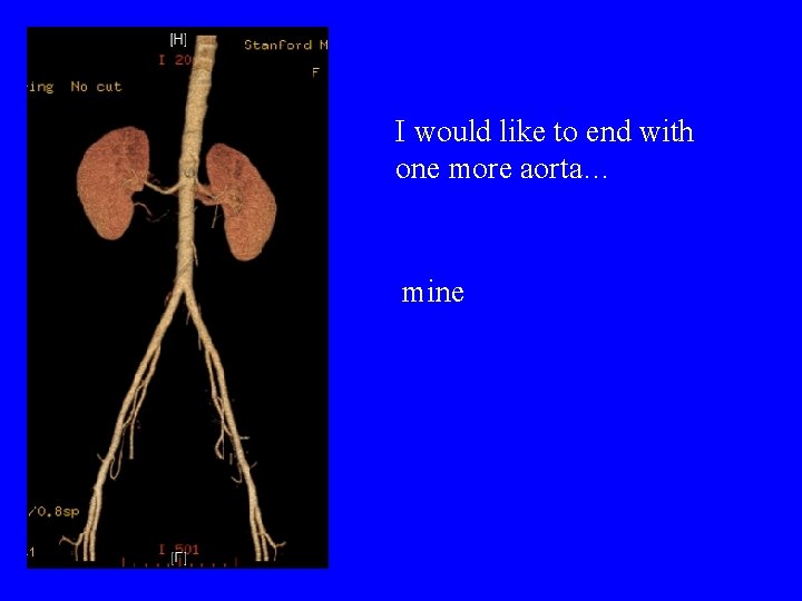 I would like to end with one more aorta… mine 