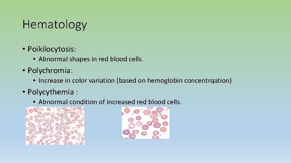 Hematology • Poikilocytosis: • Abnormal shapes in red blood cells. • Polychromia: • Increase