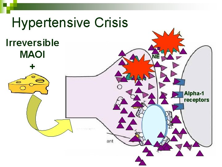 Hypertensive Crisis Irreversible MAOI + NE NE Alpha-1 receptors 