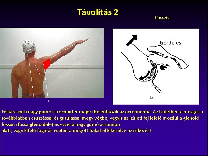 Távolítás 2 Passzív Gördülés Felkarcsonti nagy gumó ( trochanter major) beleütközik az acromionba. Az