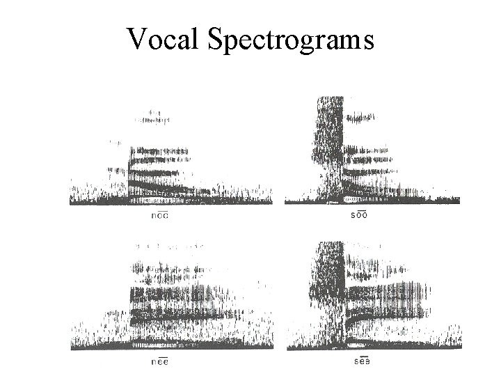 Vocal Spectrograms 