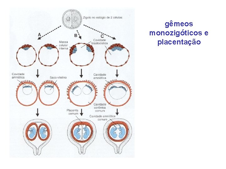 gêmeos monozigóticos e placentação 