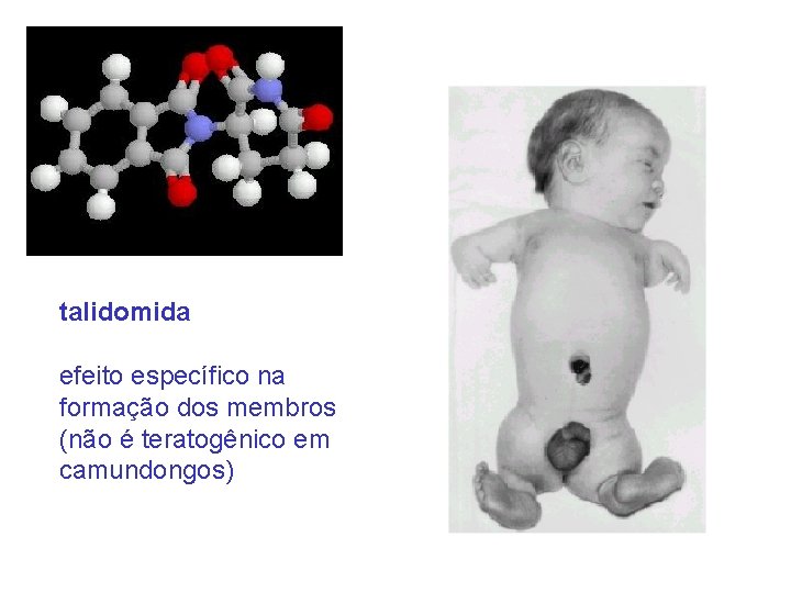 talidomida efeito específico na formação dos membros (não é teratogênico em camundongos) 