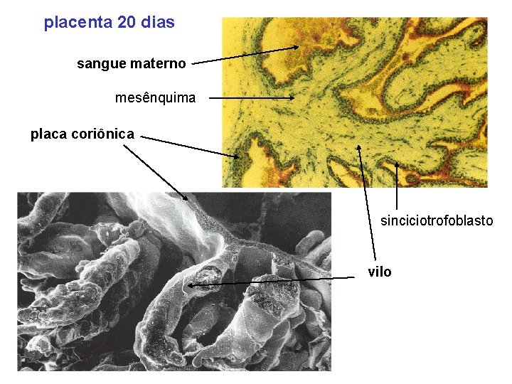placenta 20 dias sangue materno mesênquima placa coriônica sinciciotrofoblasto vilo 