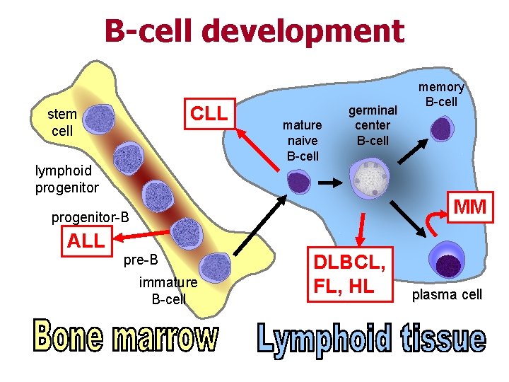 B-cell development CLL stem cell lymphoid progenitor mature naive B-cell germinal center B-cell MM