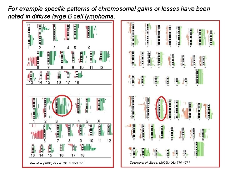 For example specific patterns of chromosomal gains or losses have been noted in diffuse