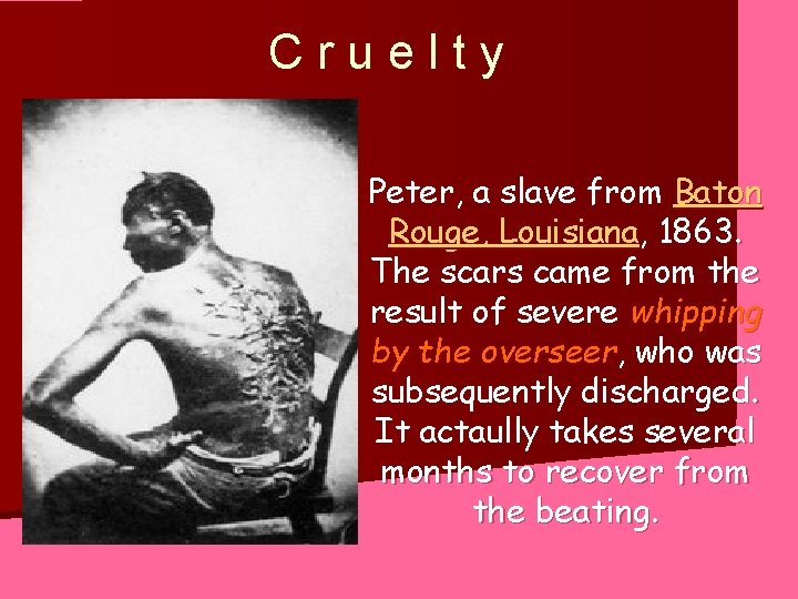 Cruelty Peter, a slave from Baton Rouge, Louisiana, 1863. The scars came from the