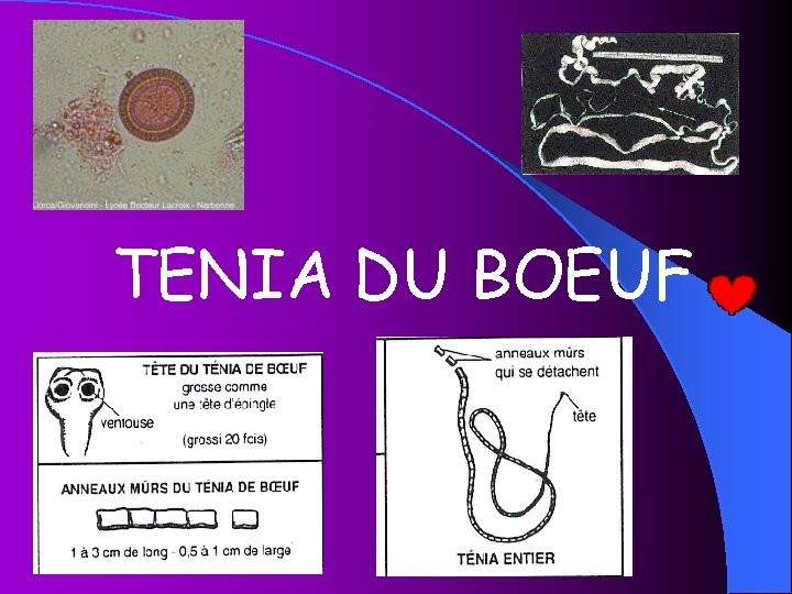 TENIA DU BOEUF 