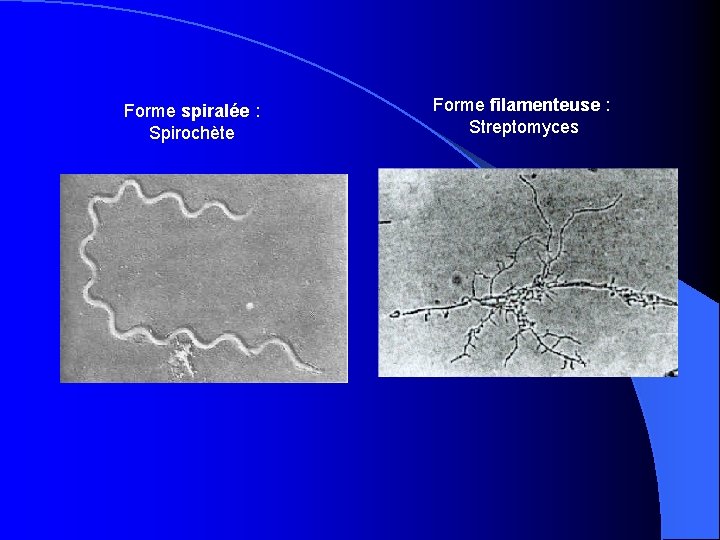 Forme spiralée : Spirochète Forme filamenteuse : Streptomyces 