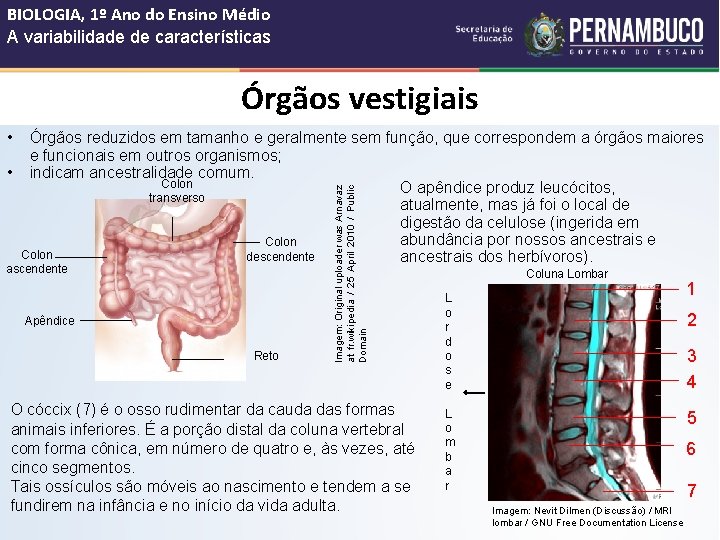 BIOLOGIA, 1º Ano do Ensino Médio A variabilidade de características Órgãos vestigiais • ascendente