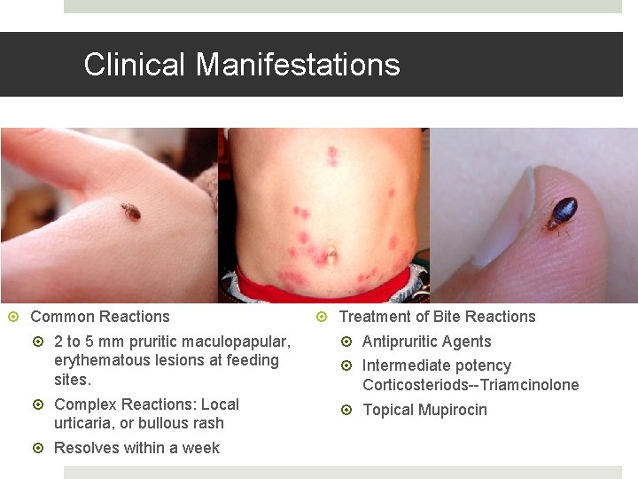 Clinical Manifestations Common Reactions 2 to 5 mm pruritic maculopapular, erythematous lesions at feeding