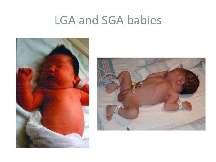 LGA and SGA babies 