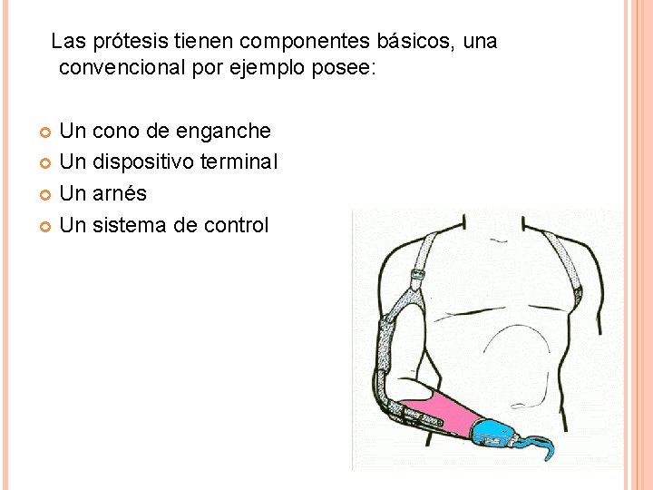 Las prótesis tienen componentes básicos, una convencional por ejemplo posee: Un cono de enganche
