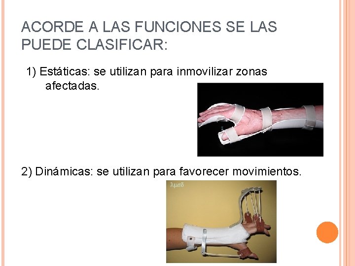 ACORDE A LAS FUNCIONES SE LAS PUEDE CLASIFICAR: 1) Estáticas: se utilizan para inmovilizar
