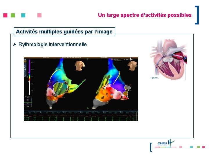 Un large spectre d’activités possibles Activités multiples guidées par l’image Ø Rythmologie interventionnelle 