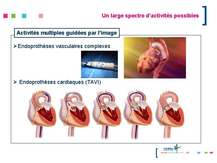 Un large spectre d’activités possibles Activités multiples guidées par l’image ØEndoprothèses vasculaires complexes Ø