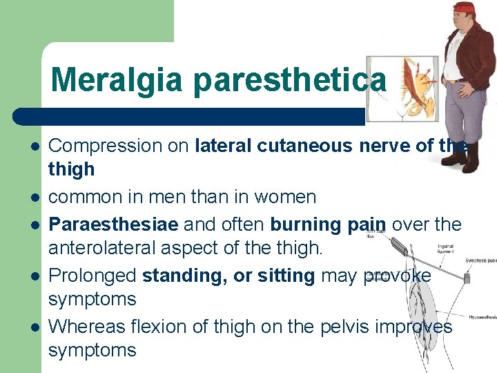 Meralgia paresthetica l l l Compression on lateral cutaneous nerve of the thigh common
