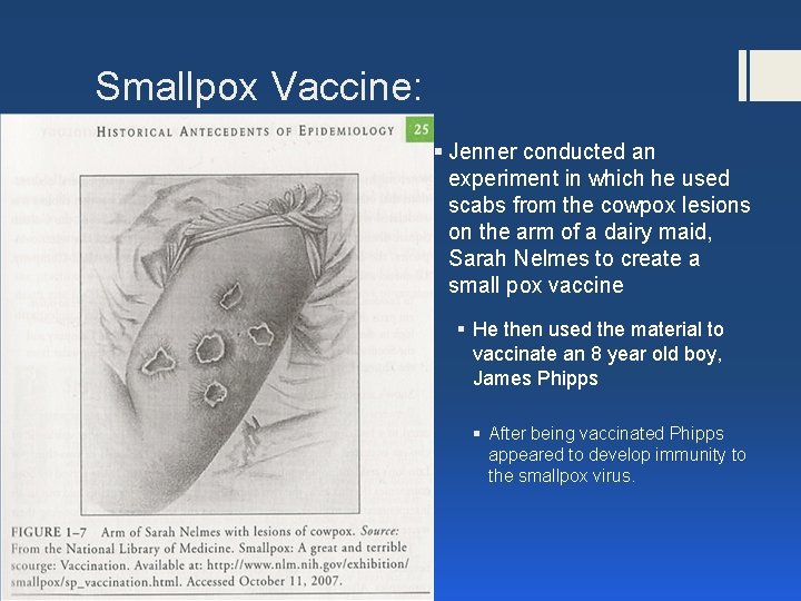 Smallpox Vaccine: § Jenner conducted an experiment in which he used scabs from the