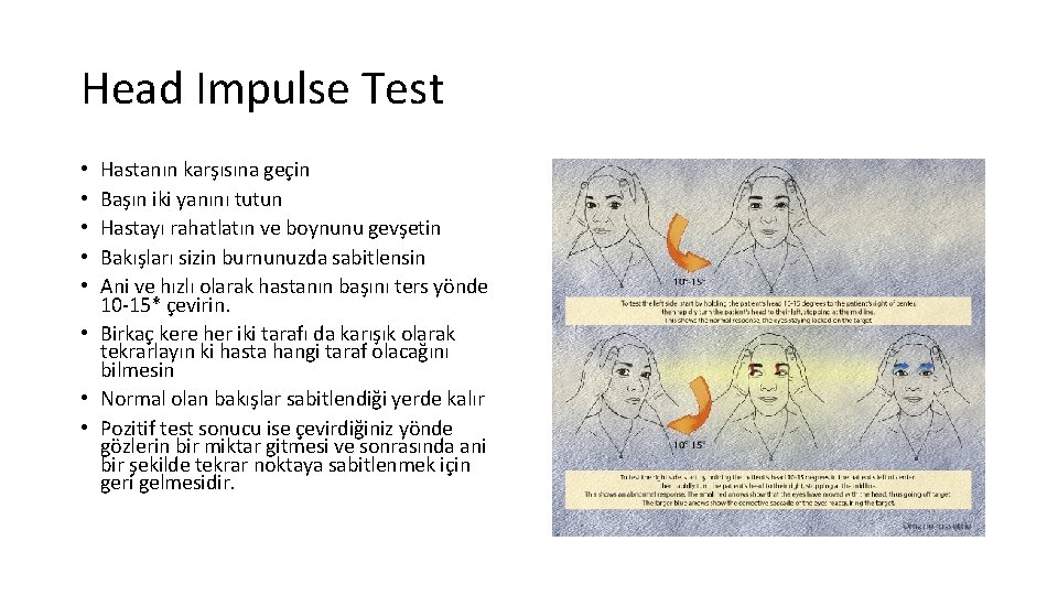 Head Impulse Test Hastanın karşısına geçin Başın iki yanını tutun Hastayı rahatlatın ve boynunu